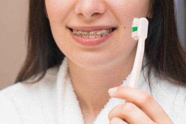 Igiena dentară cu aparat fix: cum cureți corect dinții și bracketurile